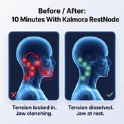 Kalmora™ RestNode
